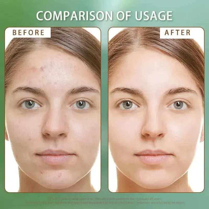 V-Line Beauty Microcrystal