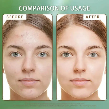 V-Line Beauty Microcrystal